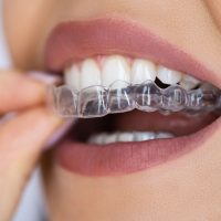 dental-patient-wearing-invisalign